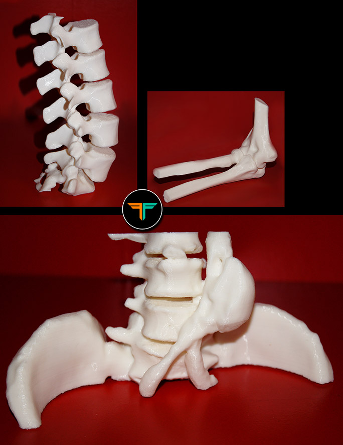 medizinische Fertigung 3D Druck